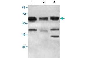 Western blot analysis of 293T (Lane 1), K-562 cells (Lane 2) and fetal heart tissue lysate with ACAD9 polyclonal antibody  at 1 : 500 dilution. (ACAD9 anticorps  (AA 1464-1642))