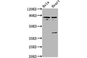 Western Blot Positive WB detected in: Hela whole cell lysate, Rat heart tissue All lanes: QSOX1 antibody at 5. (QSOX1 anticorps  (AA 101-175))