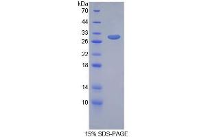 SDS-PAGE analysis of Rat GIF Protein. (Intrinsic Factor Protéine)