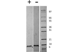 SDS-PAGE of Mouse Stromal Cell-Derived Factor-1 beta (CXCL12) Recombinant Protein SDS-PAGE of Mouse Stromal Cell-Derived Factor-1 beta (CXCL12) Recombinant Protein. (SDF1 beta Protéine)