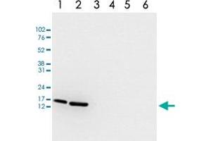 Western Blot analysis of (1) 25 ug whole cell extracts of Hela cells, (2) 15 ug histone extracts of Hela cells, (3) 1 ug of recombinant histone H2A, (4) 1 ug of recombinant histone H2B, (5) 1 ug of recombinant histone H3, (6) 1 ug of recombinant histone H4. (HIST1H3A anticorps  (acLys18))