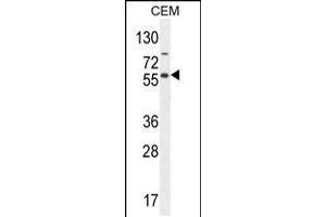 Western blot analysis in CEM cell line lysates (35ug/lane). (NFKBIL1 anticorps  (AA 256-285))