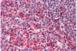 Human Spleen (formalin-fixed, paraffin-embedded) stained with PAK4 antibody ABIN214461 at 2. (PAK4 anticorps  (Internal Region))
