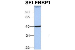 Host:  Rabbit  Target Name:  NOP56  Sample Type:  MCF7  Antibody Dilution:  1.