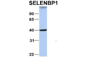 Host:  Rabbit  Target Name:  NOP56  Sample Type:  MCF7  Antibody Dilution:  1. (SELENBP1 anticorps  (C-Term))
