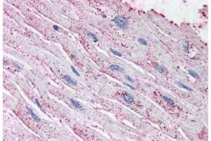 Immunohistochemistry (Formalin/PFA-fixed paraffin-embedded sections) of human heart tissue with EDNRA polyclonal antibody . (Endothelin-1 Receptor anticorps  (N-Term))