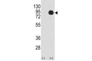 Western blot analysis of BRAF antibody and 293 cell lysate (2 ug/lane) either nontransfected (Lane 1) or transiently transfected with the B-RAF gene (2).