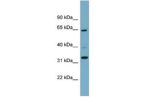 WB Suggested Anti-ZNF791 Antibody Titration:  0.