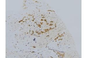 ABIN6273025 at 1/100 staining Human lung tissue by IHC-P. (VPS33B anticorps)