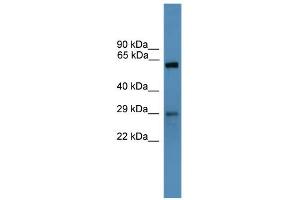 WB Suggested Anti-TP53RK Antibody Titration: 0. (TP53RK anticorps  (N-Term))