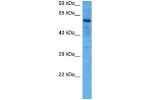 Host:  Rabbit  Target Name:  SOX9  Sample Tissue:  Mouse Brain  Antibody Dilution:  1ug/ml (SOX9 anticorps  (N-Term))