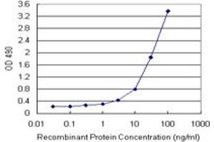 SERPINA3 (Human) Matched Antibody Pair