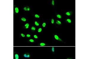 Immunofluorescence analysis of HepG2 cells using FCGR2A Polyclonal Antibody