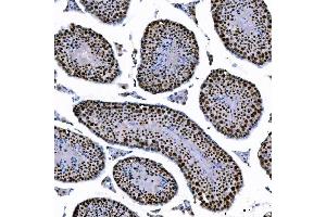 IHC analysis of SAE1 using anti-SAE1 antibody (ABIN7601346). (SAE1 anticorps  (AA 33-299))