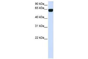 Western Blotting (WB) image for anti-Phosphatidylinositol Glycan T (PIGT) antibody (ABIN2459077) (PIGT anticorps)