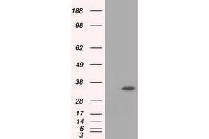 HEK293T cells were transfected with the pCMV6-ENTRY control (Left lane) or pCMV6-ENTRY EIF2S1 (Right lane) cDNA for 48 hrs and lysed. (EIF2S1 anticorps)