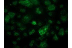 Image no. 4 for anti-Tumor Protein P53 (TP53) antibody (ABIN1499971) (p53 anticorps)
