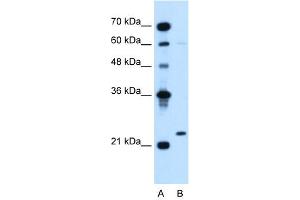 WB Suggested Anti-IGLL1  Antibody Titration: 5. (IGLL1 anticorps  (N-Term))