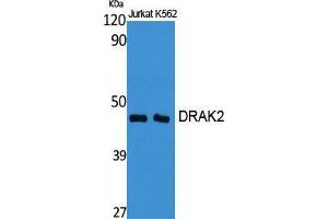 Western Blot (WB) analysis of specific cells using DRAK2 Polyclonal Antibody. (DRAK2 anticorps  (Internal Region))
