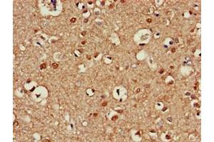 Immunohistochemistry of paraffin-embedded human brain tissue using ABIN7145099 at dilution of 1:100