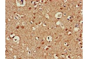 Immunohistochemistry of paraffin-embedded human brain tissue using ABIN7145099 at dilution of 1:100 (ATG13 anticorps  (AA 315-517))
