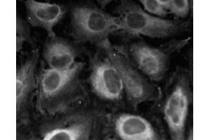 Immunofluorescent staining of HeLa (ATCC CCL-2) cells. (Caveolin-1 anticorps  (AA 1-97))
