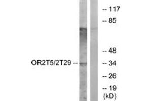 Western blot analysis of extracts from K562 cells, using OR2T5/2T29 Antibody.
