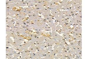 ABIN7097059 and ABIN7101126 at 1/100 staining rat heart tissue by IHC-P. (PSTK anticorps)