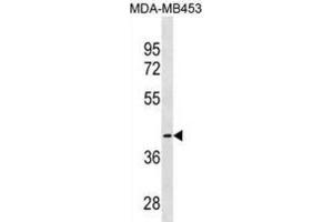 Western Blotting (WB) image for anti-Cysteine-S-conjugate beta-Lyase (CCBL1) antibody (ABIN3000294) (CCBL1 anticorps)