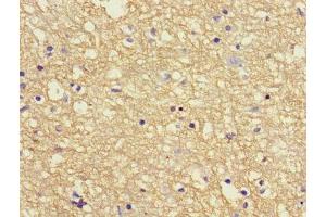Immunohistochemistry of paraffin-embedded human brain tissue using ABIN7144042 at dilution of 1:100 (APP anticorps  (AA 18-270))
