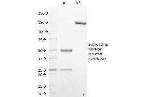 SDS-PAGE Analysis Purified STAT6 Mouse Monoclonal Antibody (STAT6/2410).