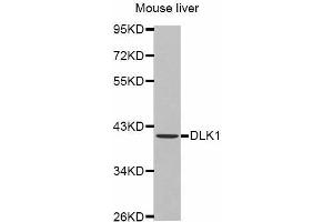 Western Blotting (WB) image for anti-delta-Like 1 Homolog (Drosophila) (DLK1) antibody (ABIN6219768) (DLK1 anticorps)