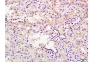 Formalin-fixed and paraffin embedded mouse kidney labeled with Rabbit Anti CaMK2 alpha Polyclonal Antibody, Unconjugated (ABIN1386359) at 1:200 followed by conjugation to the secondary antibody and DAB staining (CAMK2B anticorps  (AA 101-200))