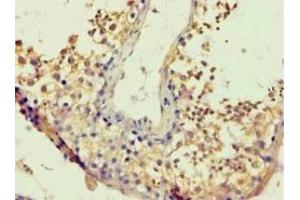 Immunohistochemistry analysis of paraffin-embedded (BACH1 anticorps  (AA 1-320))