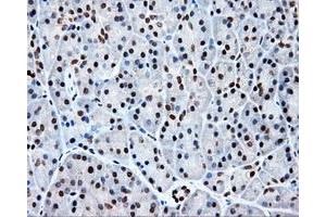 Immunohistochemical staining of paraffin-embedded colon tissue using anti-KIAA1609 mouse monoclonal antibody. (KIAA1609 anticorps)