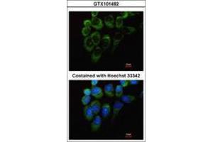Image no. 2 for anti-Tyrosyl-tRNA Synthetase (Yars) (AA 357-520) antibody (ABIN467437)
