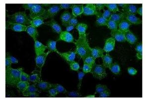 IF analysis of gamma Catenin using anti-gamma Catenin antibody (ABIN3043864).