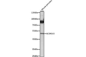 Western blot analysis of extracts of mouse pancreas, using  antibody (ABIN7265533) at 1:1000 dilution. (ALDH1A3 anticorps  (AA 1-140))