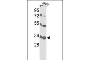 Western blot analysis of VDAC1 Antibody (Center) (ABIN390564 and ABIN2840894) in HL-60, Y79 cell line lysates (35 μg/lane). (VDAC1 anticorps  (AA 95-124))