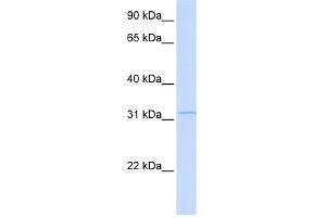 WB Suggested Anti-RDH12 Antibody Titration: 0. (RDH12 anticorps  (Middle Region))
