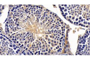 Detection of AMH in Mouse Testis Tissue using Monoclonal Antibody to Anti-Mullerian Hormone (AMH) (AMH anticorps  (AA 453-560))