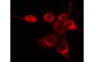 ABIN6274423 staining Hela cells by IF/ICC. (FUK anticorps  (N-Term))