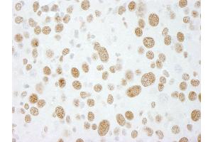 Immunohistochemistry (IHC) image for anti-RNA-binding protein Raly (RALY) (AA 256-306) antibody (ABIN7448753) (Raly anticorps  (AA 256-306))