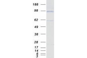Hemogen (HEMGN) (Transcript Variant 1) protein (Myc-DYKDDDDK Tag)