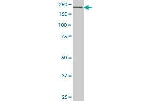 CDC42BPB monoclonal antibody (M03), clone 2F4 Western Blot analysis of CDC42BPB expression in A-431 .