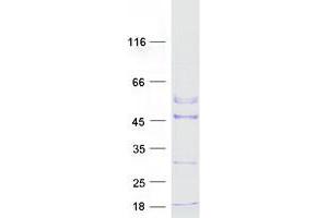 Validation with Western Blot
