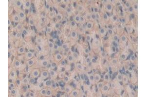 Detection of CD147 in Rat Stomach Tissue using Polyclonal Antibody to Cluster Of Differentiation 147 (CD147)