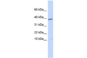 WB Suggested Anti-LEFTY1 Antibody Titration: 0.