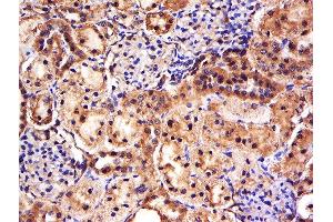 Formalin-fixed and paraffin embedded rat kidney labeled with Anti-FAM171A1 Polyclonal Antibody, Unconjugated  at 1:500 followed by conjugation to the secondary antibody and DAB staining. (FAM171A1 anticorps  (AA 201-300))