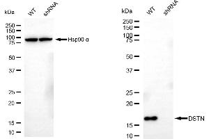 anti-Destrin (Actin Depolymerizing Factor) (DSTN) antibody